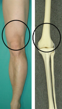図1．黒丸に囲まれた部分が大腿骨遠位部