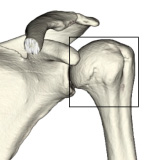 図1　肩関節（□が、上腕骨近位端）