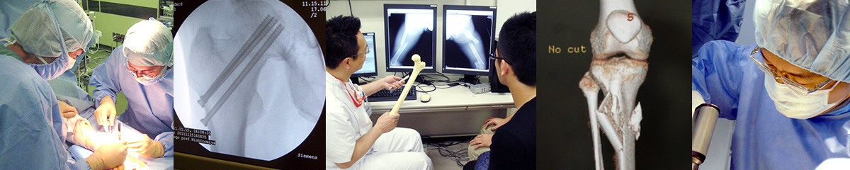 Japanese Society for Fracture Reapair