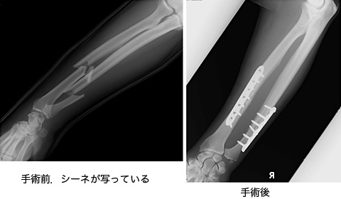 ぼ が 折れる ね き 心が折れた時の立ち直り方は？原因や折れやすい人の特徴をご紹介