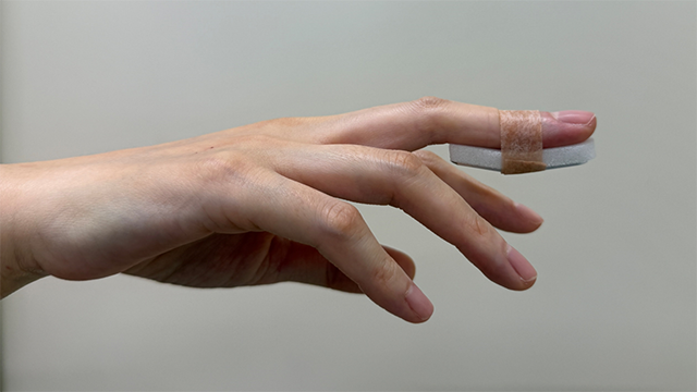 図6.シーネを用いた装具