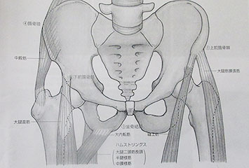 図5　骨盤裂離骨折