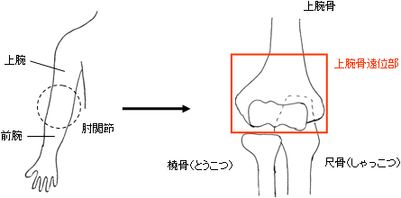 腕骨 骨折 上 上 顆 😊上 腕骨